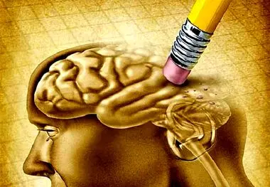 هشدار درباره ابتلا به آلزایمر/ چند درصد این افراد مبتلا می‌شوند؟
