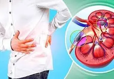 با این خوردنی ها سنگ کلیه را آب کنید
