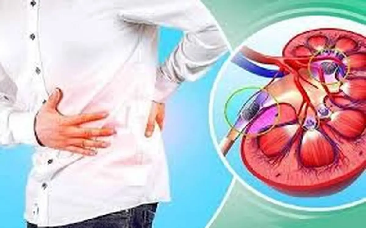 با این خوردنی ها سنگ کلیه را آب کنید