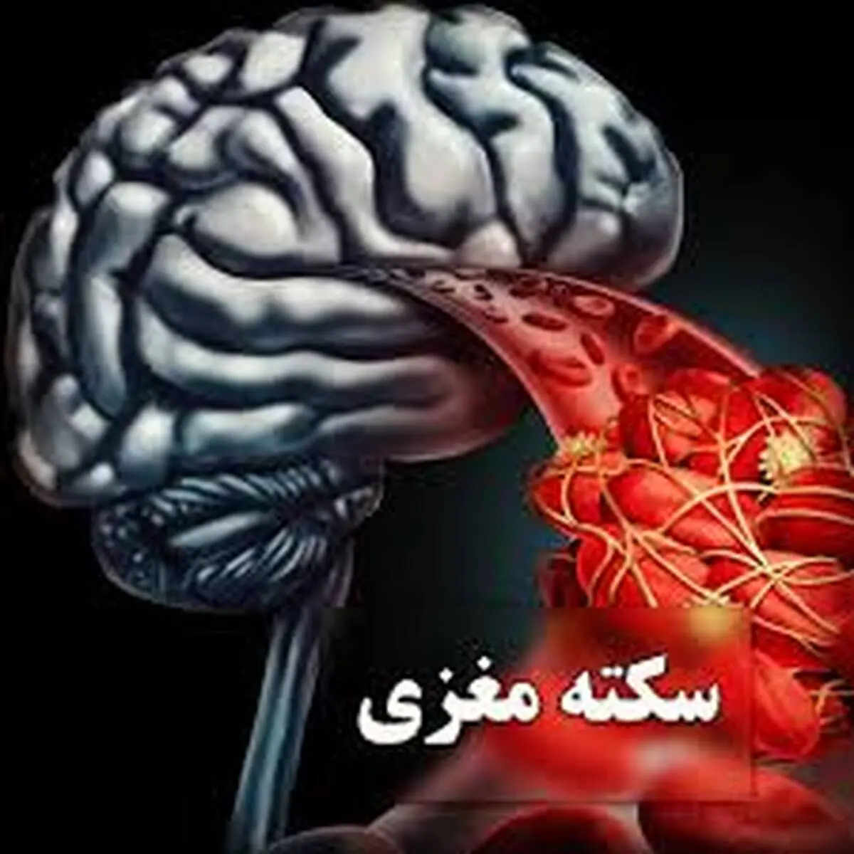 این اقدام را انجام دهید تا از سکته مغزی جان سالم به در ببرید
