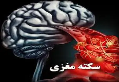 این اقدام را انجام دهید تا از سکته مغزی جان سالم به در ببرید
