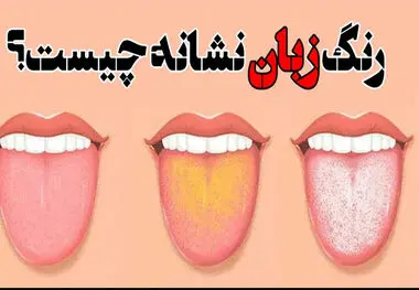 رنگ زبان نشان دهنده چه بیماری هایی است؟