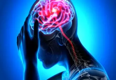 سکته مغزی سالانه بیش از نیم میلیون ایرانی را به کام مرگ می‌کشاند