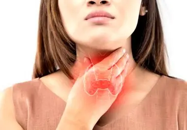 این افراد در معرض ابتلا به پرکاری تیروئید