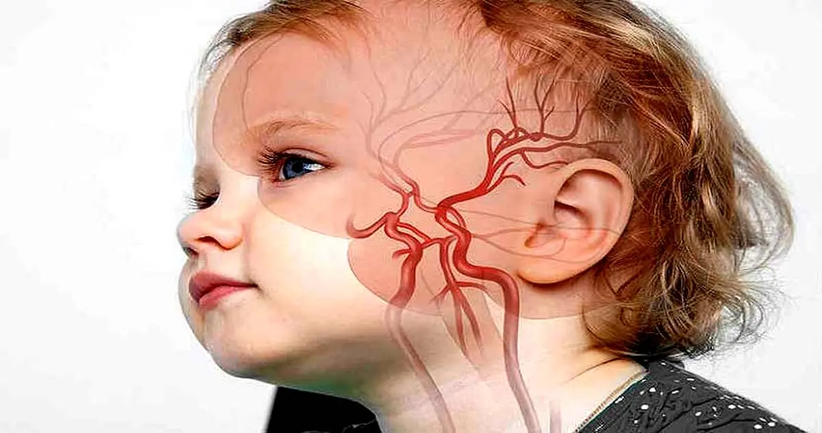 جوان‌های ایرانی رکورددار سکته مغزی