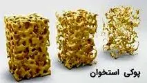 «کلسیم نانویی ایرانی» به درمان پوکی استخوان کمک می‌کند