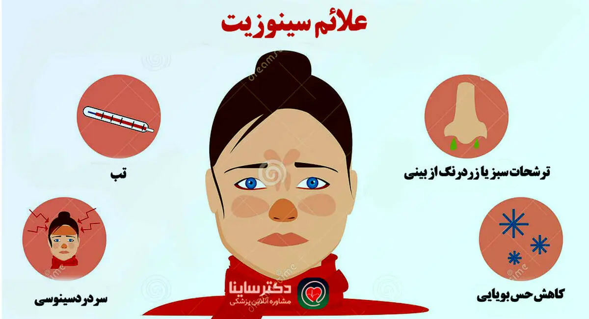 علائم سینوزیت را بشناسید