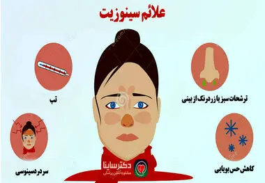 علائم سینوزیت را بشناسید