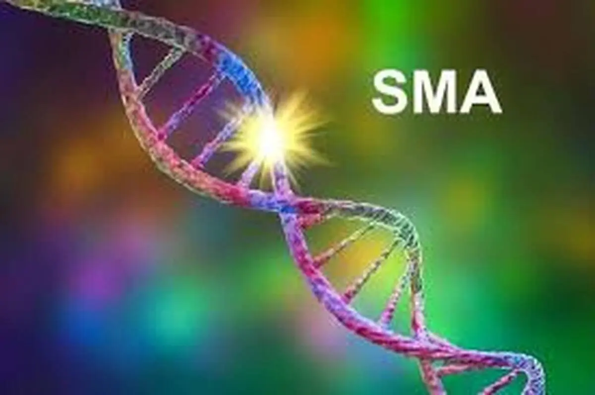 آخرین تصمیم درباره بیماران SMA اعلام شد