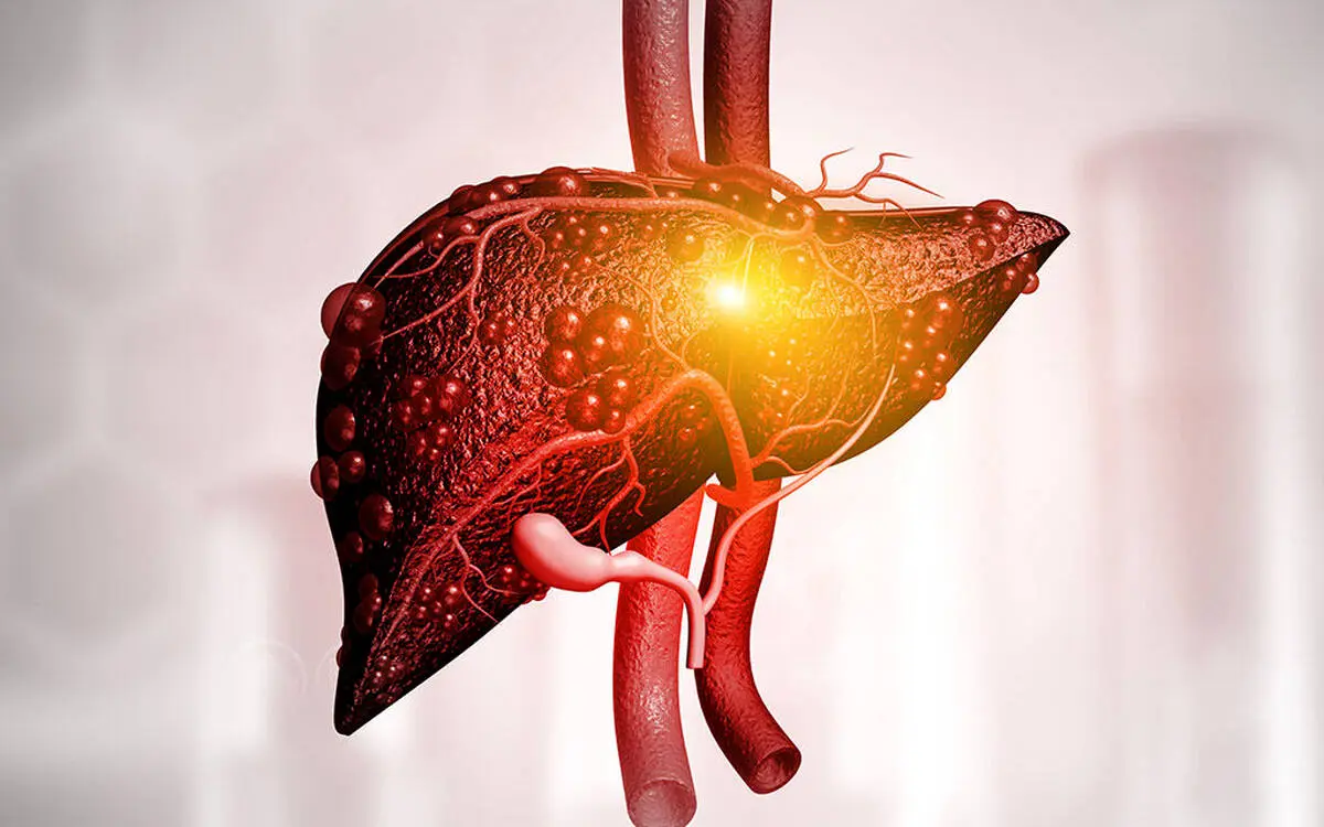 این کارها از چرب شدن کبد جلوگیری می‌کند