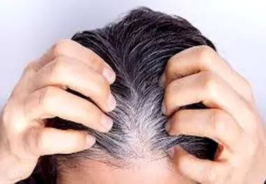 این میوه ها ترمز سفیدی مو را می کشند