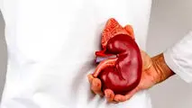 ۸ علت ابتلا به بیماری‌های کلیوی