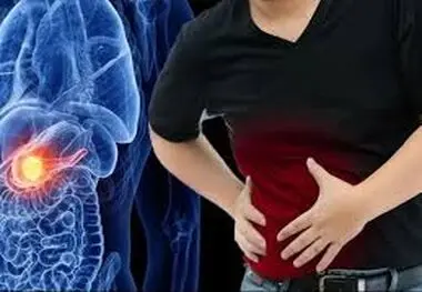 این افراد بیشتر سرطان پانکراس می گیرند