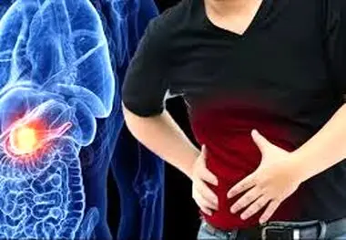 این افراد بیشتر سرطان پانکراس می گیرند