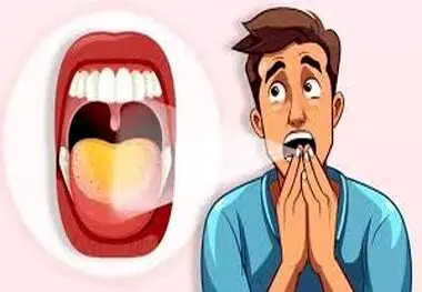 دلایل زردی زبان چیست؟