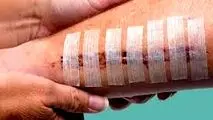 دلیل دیر خوب شدن زخم ها کمبود این ویتامین است