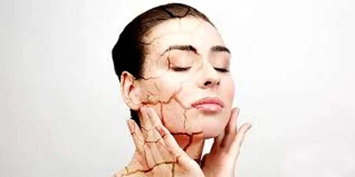 چطور به کمک تغذیه خشکی پوست را درمان کنیم؟
