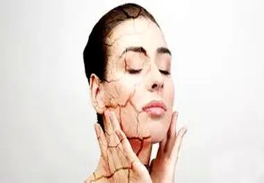 چطور به کمک تغذیه خشکی پوست را درمان کنیم؟