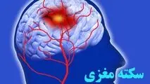 علائمی ساده که باورتان نمی شود خبر از سکته مغزی می دهند!
