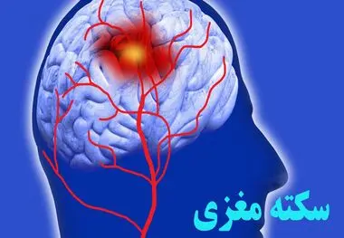 علائمی ساده که باورتان نمی شود خبر از سکته مغزی می دهند!
