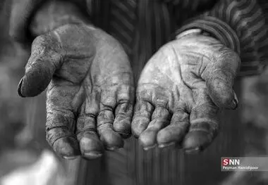 دستمزد در مسیر جراحی؛ حقوق کارگران دو نوبته می‌شود؟